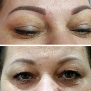 Before and after permanent makeup