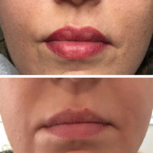 Before and after permanent makeup